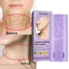 Double Chin Eliminate Neck Fine Lines - Image 2