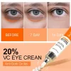 Anti Eye Bag Eye Cream Firmness Moisturizing - Image 3