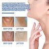 Collagen Neck Lines Protein Cream - Image 4