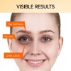 Anti Eye Bag Eye Cream Firmness Moisturizing - Image 4