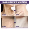 Double Chin Eliminate Neck Fine Lines - Image 6