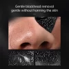 Auquest Blackhead Remover Facial Masks - Image 5
