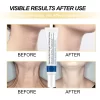 Collagen Neck Lines Protein Cream - Image 3
