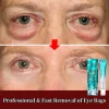 Anti-Wrinkle Eye Cream